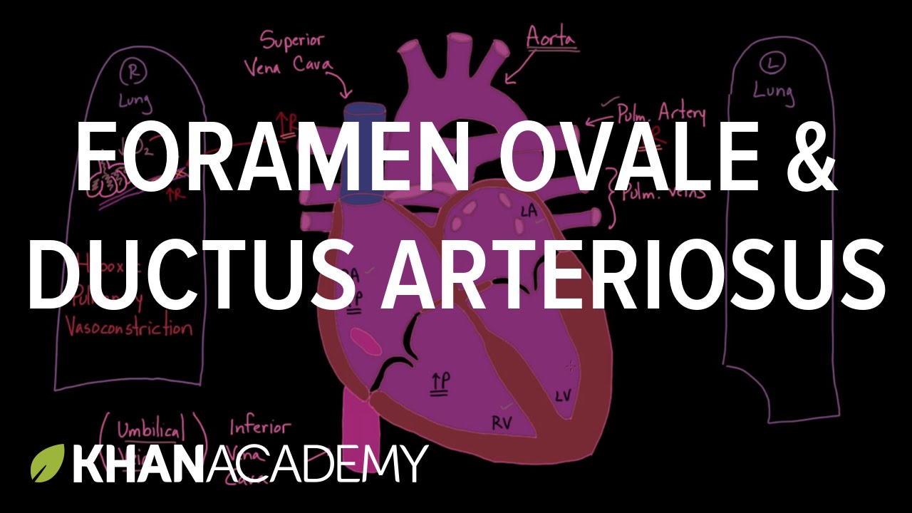 patent-ductus-arteriosus-pda-how-to-guide-tips-and-tricks